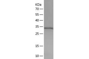 TPM3 Protein (AA 6-246) (His tag)