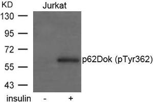 Western blot analysis of extracts from Jurkat cells untreated or treated with insulin using p62Dok(phospho-Tyr362) Antibody. (DOK1 antibody  (pTyr362))