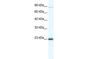 Western Blotting (WB) image for anti-Minichromosome Maintenance Deficient 4 (MCM4) antibody (ABIN2461399) (MCM4 antibody)