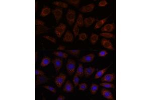 Immunofluorescence analysis of L929 cells using SEC24D antibody (ABIN7270171) at dilution of 1:100. (SEC24D antibody  (AA 830-1000))