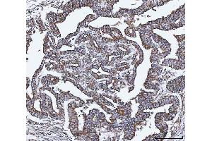 IHC analysis of VAPA using anti-VAPA antibody (ABIN7603249). (VAPA antibody  (N-Term))