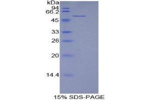 SDS-PAGE (SDS) image for Laminin, beta 1 (LAMB1) (AA 549-767) protein (His tag) (ABIN1877568) (Laminin beta 1 Protein (AA 549-767) (His tag))