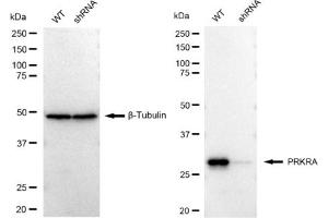 Western blotting analysis using PRKRA antibody (ABIN7800015). (Recombinant PRKRA antibody)