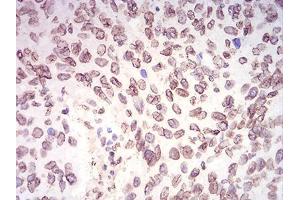 Immunohistochemistry (IHC) image for anti-Lamin B2 (LMNB2) (AA 401-600) antibody (ABIN5542337)