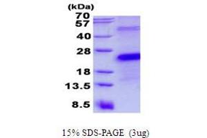 Image no. 1 for CD27 Molecule (CD27) protein (His tag) (ABIN1098678) (CD27 Protein (His tag))