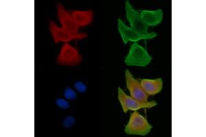 ABIN7095380 and ABIN7099437 staining Hela cells(45 min of heat-shock treatment) by IF/ICC. (VKORC1L1 antibody)