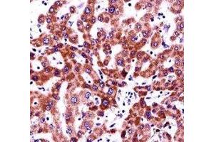 Integrin beta 5 antibody immunohistochemistry analysis in formalin fixed and paraffin embedded human liver tissue. (Integrin beta 5 antibody  (AA 216-244))