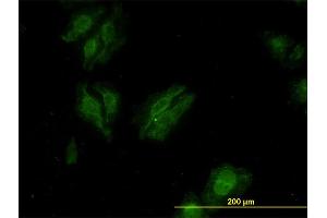 Immunofluorescence of monoclonal antibody to KSR2 on HeLa cell. (KSR2 antibody  (AA 411-500))