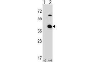 Western Blotting (WB) image for anti-Serine/threonine Kinase Receptor Associated Protein (STRAP) antibody (ABIN3001728) (STRAP antibody)