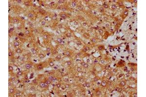 IHC image of ABIN7147604 diluted at 1:300 and staining in paraffin-embedded human liver tissue performed on a Leica BondTM system. (CYP7A1 antibody  (AA 303-423))