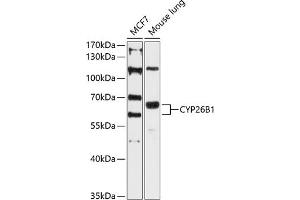 Western blot analysis of extracts of various cell lines, using CYP26B1 antibody (ABIN6130158, ABIN6139325, ABIN6139326 and ABIN6215727) at 1:3000 dilution. (CYP26B1 antibody  (AA 213-512))
