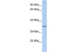 WB Suggested Anti-SCAND2 Antibody Titration:  0. (SCAND2 antibody  (N-Term))