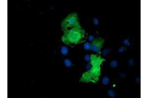 Anti-EPN2 mouse monoclonal antibody (ABIN2455554) immunofluorescent staining of COS7 cells transiently transfected by pCMV6-ENTRY EPN2 (RC213652). (Epsin 2 antibody)
