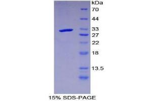 SDS-PAGE analysis of Mouse LRIG3 Protein. (LRIG3 Protein)