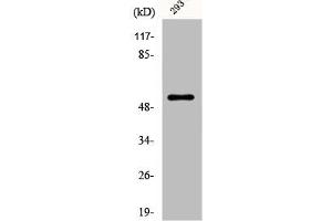 Western Blot analysis of 293 cells using Dematin Polyclonal Antibody (Dematin antibody)
