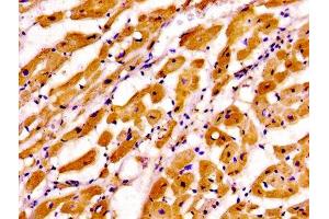 Immunohistochemistry of paraffin-embedded human heart tissue using ABIN7173574 at dilution of 1:100 (TNNI3 antibody  (AA 2-210))