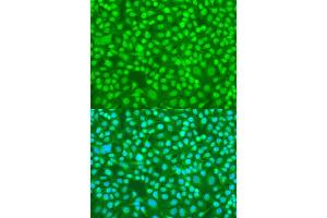Immunofluorescence analysis of U2OS cells using SRSF9 antibody (ABIN6293561) at dilution of 1:100.
