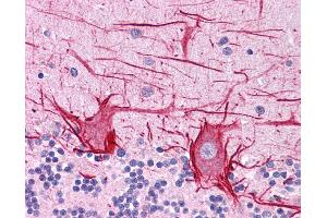 ApoB antibody was used for immunohistochemistry at a concentration of 4-8 ug/ml. (APOB antibody  (Middle Region))