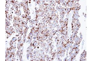 IHC-P Image Immunohistochemical analysis of paraffin-embedded OVCAR3 xenograft, using Prohibitin, antibody at 1:500 dilution.