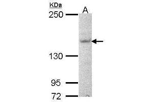 WB Image Sample (30 ug of whole cell lysate) A: NT2D1 5% SDS PAGE antibody diluted at 1:1000 (AHI1 antibody  (N-Term))