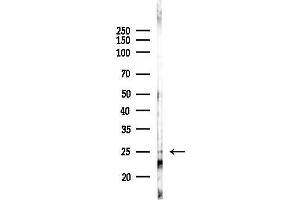 anti-FEV (ETS Oncogene Family) (FEV) (N-Term) antibody