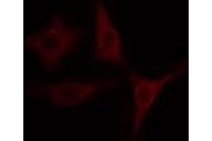 ABIN6274507 staining COLO205 cells by IF/ICC. (SLK antibody  (C-Term))