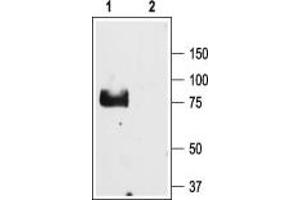 Western Blotting (WB) image for anti-Sodium Channel, Nonvoltage-Gated 1, gamma (SCNN1G) (AA 129-142), (Extracellular) antibody (ABIN7043636)