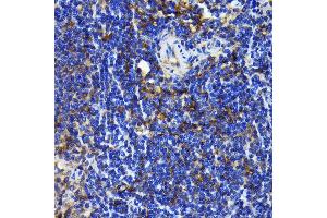 Immunohistochemistry of paraffin-embedded rat spleen using NF-kB p65/RelA antibody (ABIN7268995) at dilution of 1:100 (40x lens). (NF-kB p65 antibody)