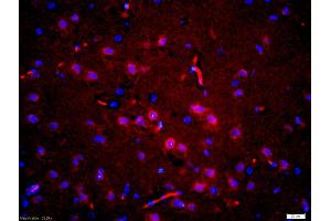 Formalin-fixed and paraffin embedded rat brain labeled with Anti-phospho-Tau protein(Thr181)Polyclonal Antibody, Unconjugated (ABIN1387422) at 1:200 followed by conjugation to the secondary antibody Goat Anti-Rabbit IgG, Cy3 conjugated used at 1:200 dilution for 40 minutes at 37 °C and DAPI staining (tau antibody  (pThr181))