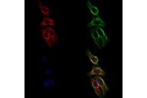 ABIN6258793 and ABIN6275993 staining Hela cells by IF/ICC.