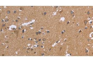 Immunohistochemistry of paraffin-embedded Human brain tissue using KIAA1324 Polyclonal Antibody at dilution 1:30 (ELAPOR1 antibody)