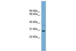 Image no. 1 for anti-Stratifin (SFN) (AA 51-100) antibody (ABIN6745577) (14-3-3 sigma/SFN antibody  (AA 51-100))