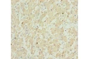 Immunohistochemistry of paraffin-embedded human liver tissue using ABIN7151911 at dilution of 1:100 (GPX5 antibody  (AA 1-100))