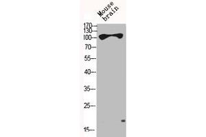 Western Blot analysis of MOUSE-BRAIN cells using HXK I Polyclonal Antibody (Hexokinase 1 antibody  (N-Term))