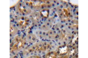 Used in DAB staining on fromalin fixed paraffin-embedded kidney tissue (Annexin a1 antibody  (AA 1-346))