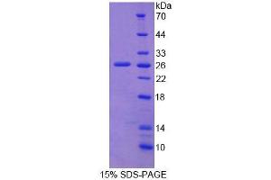 SDS-PAGE (SDS) image for Fibulin 2 (FBLN2) (AA 858-1069) protein (His tag) (ABIN1099082) (FBLN2 Protein (AA 858-1069) (His tag))