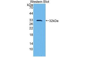 Detection of Recombinant uPA, Mouse using Polyclonal Antibody to Plasminogen Activator, Urokinase (uPA) (PLAU antibody  (AA 180-433))