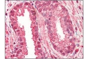Immunohistochemistry (IHC) image for anti-Cathepsin L1 (CTSL1) (AA 114-333) antibody (ABIN317508) (Cathepsin L antibody  (AA 114-333))