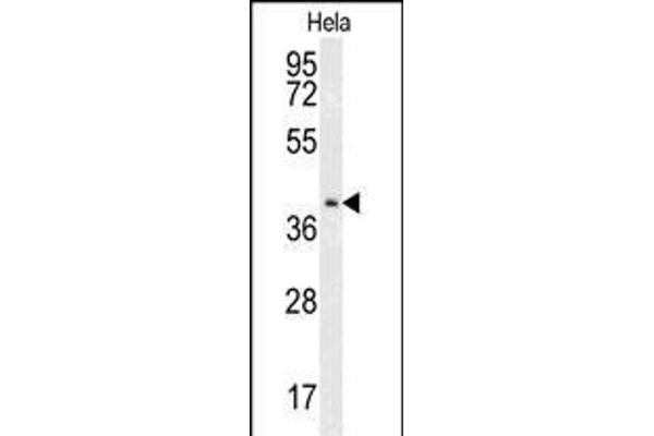 CMPK2 antibody  (AA 142-170)