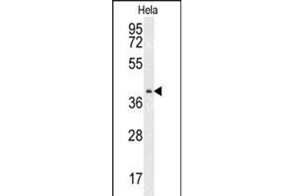 CMPK2 anticorps  (AA 142-170)