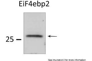 Sample Type: HEK 293 cells (50ug)Primary Dilution: 1:1000Image Submitted by: Veronique DorvalLaval University, Canada . (eIF4EBP2 antibody  (N-Term))