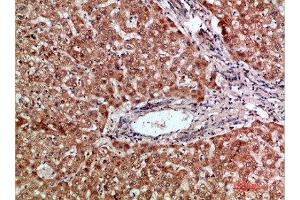 Immunohistochemical analysis of paraffin-embedded human-liver, antibody was diluted at 1:200 (CCL2 antibody  (AA 31-80))