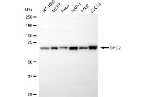 Western blotting analysis using GPD2 antibody (ABIN7798770).
