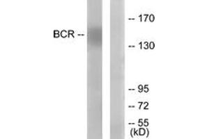 Western blot analysis of extracts from K562 cells, using Bcr (Ab-177) Antibody.