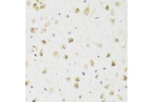Immunohistochemistry of paraffin-embedded rat brain using PAWR Antibody (ABIN1874043) at dilution of 1:100 (40x lens).