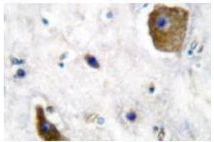 Image no. 1 for anti-Glutamate Decarboxylase 1 (Brain, 67kDa) (GAD1) antibody (ABIN265428) (GAD antibody)