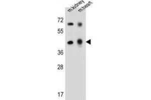 Western Blotting (WB) image for anti-Adenosine Deaminase-Like Protein (ADAL) antibody (ABIN2997438) (ADAL antibody)