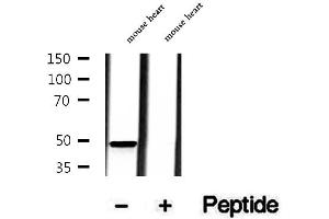 Western blot analysis of extracts of mouse heart tissue, using MMP28 antibody. (MMP28 antibody  (Internal Region))