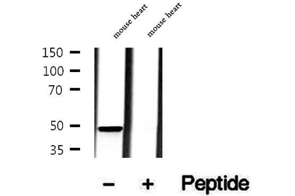 MMP28 antibody  (Internal Region)