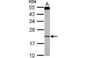 WB Image Sample (30 ug of whole cell lysate) A: HeLa nucleus 12% SDS PAGE antibody diluted at 1:500 (PDCD6 antibody)